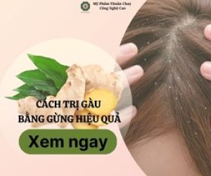 Cách trị gàu bằng gừng hiệu quả