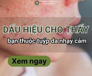 Dấu hiệu cho thấy bạn thuộc tuýp da nhạy cảm