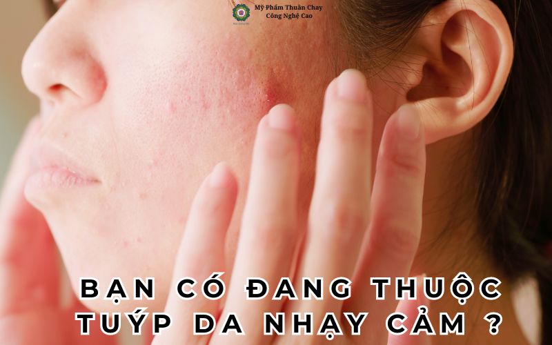 ban-co-dang-thuoc-tuyp-da-nhay-cam