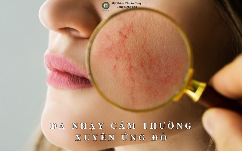 da-nhay-cam-thuong-xuyen-ung-do