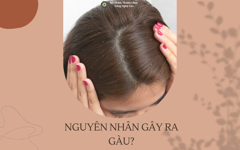 nguyen-nhan-gay-ra-gau